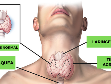 ¿ES EFECTIVA LA DIETA KETO EN PERSONAS QUE PADECEN TIROIDITIS DE HASHIMOTO?