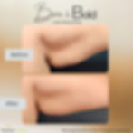 Arm Contouring Set2 (2)