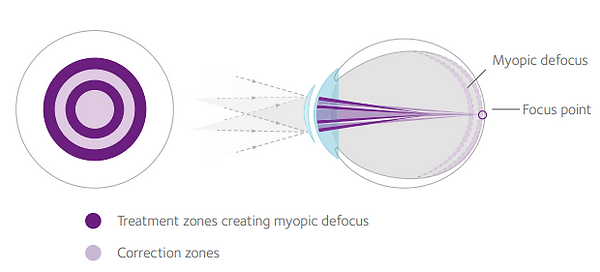 misight design.PNG