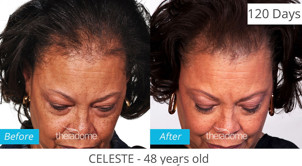 Thumbnail: Before and after hair growth