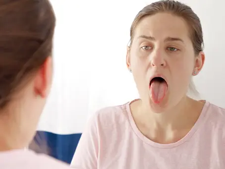 Got White Tongue? Learn the Causes and Prevention from a Trusted Dental Clinic