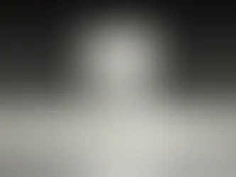 Wisdom Tooth Removal Recovery Tips: A Guide from By The Lake Dental