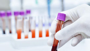 Alzheimer: novo exame de sangue pode detectar Alzheimer precocemente