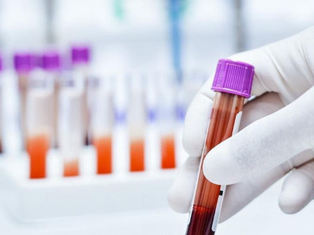 Alzheimer: novo exame de sangue pode detectar Alzheimer precocemente