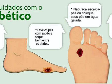 Diabetes: Saiba por que reforçar o cuidado com os pés