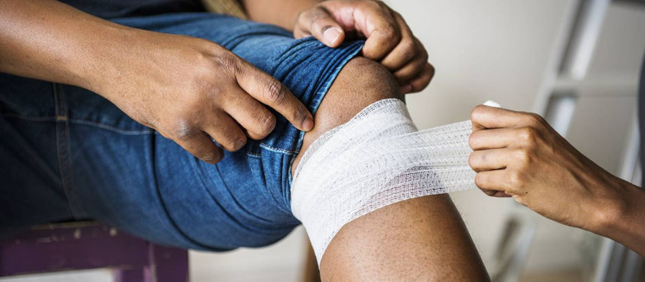 COMO TRATAR, DE MANEIRA EFICAZ, QUEIMADURAS LEVES NA PELE?