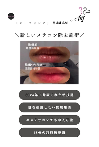 Roma Park ローマピンクLEDライト ローマピンクジャパン公式