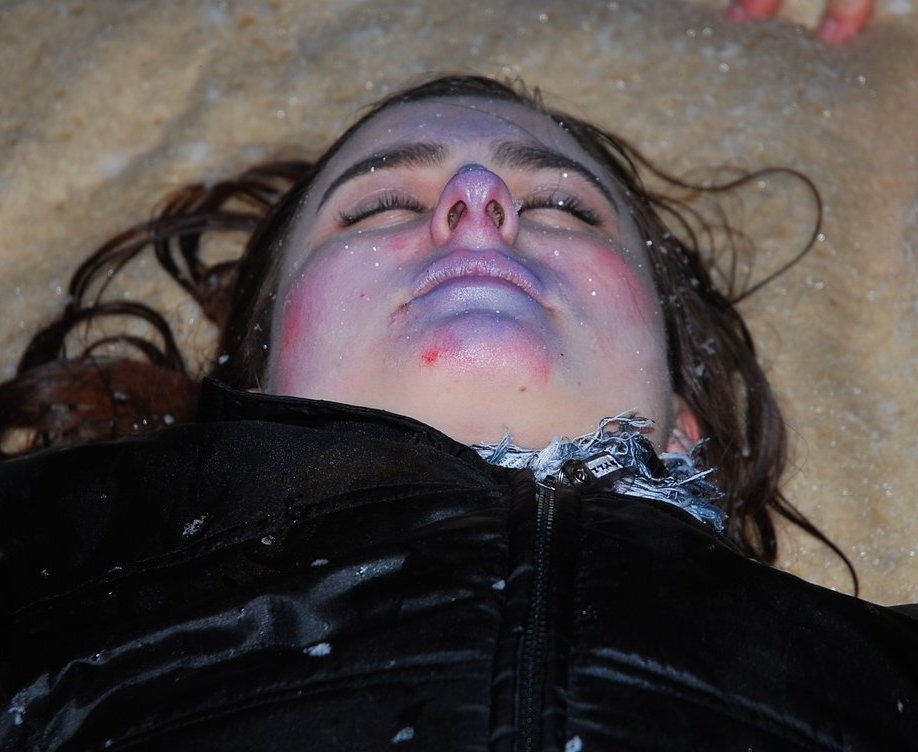 Omrzliny — neboj se pomoci!