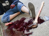 Ztrátové poranění – neboj se pomoci!