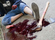 Ztrátové poranění – neboj se pomoci!