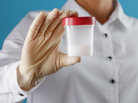 semen sample