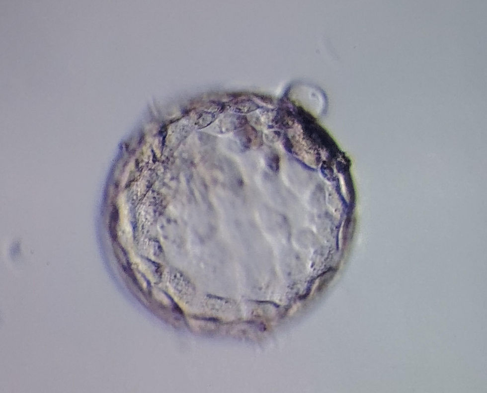 Blastocyst