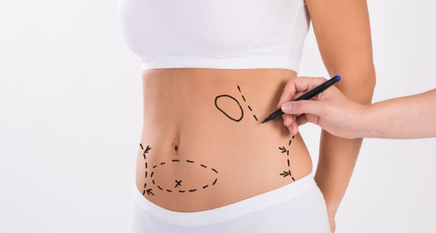 foto lipo 2.jpg