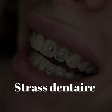 strass dentaire dent blanche 77 Lagny sur marne blanchiment dentaire 