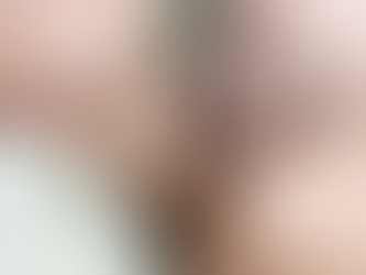 O que você precisa saber sobre a acupuntura