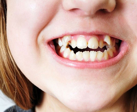 allineamento denti genova
