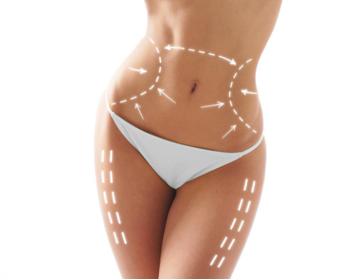 BODY CONTOURING