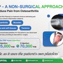PRP - A Non-Surgical Approach
