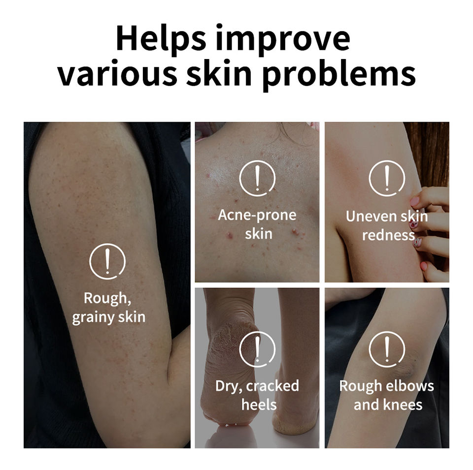 Miniatura: Lakerain Glycolic Acid Exfoliating Body Stick – Targeted Skin Renewal ✨