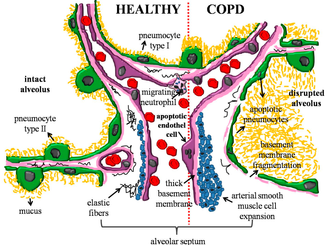 Pulmonary rehabilitation and endothelial function in patients with chronic obstructive pulmonary