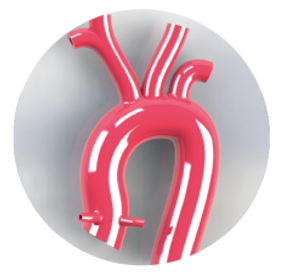 icn_livelong_autoaorta.webp