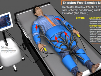 External counterpulsation stimulation combined with acupuncture for vascular endothelial function