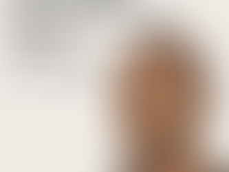 What Is Scalp Micropigmentation (SMP)? The Ultimate Guide to Hair Loss Camouflage