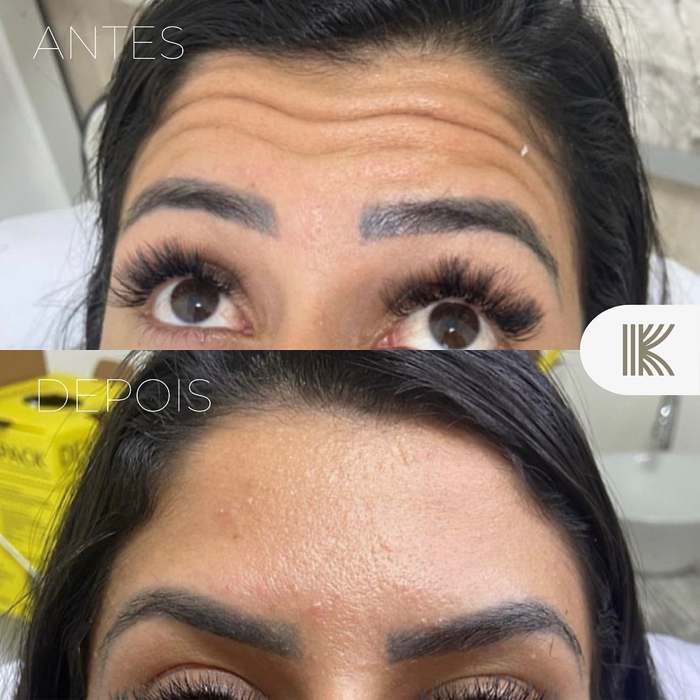 Seja membro do Clube do Botox
