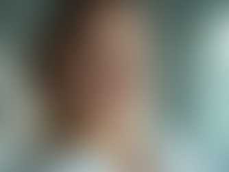 Tratamientos estéticos personalizados para tu mejor versión