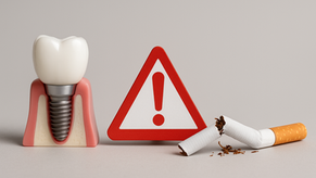Smoking and Dental Implants: What You Need to Know (From a Dentist Who Gets It)