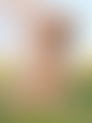 Golden Allergies- What Foods to Avoid With Your Golden Retriever