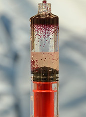 Radiologie Interventionnelle Embolisation Docteur Novelli Peupliers