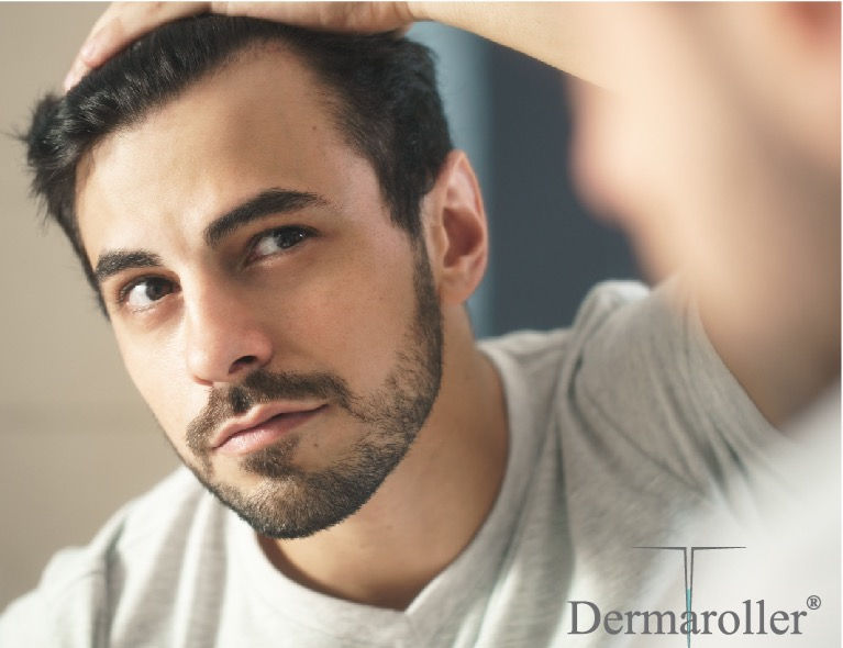 Man observing visible hair regrowth after hair restoration microneedling treatment in Vancouver