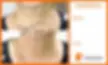Neck Rejuvenation Vancouver – Venus Rings Reduction