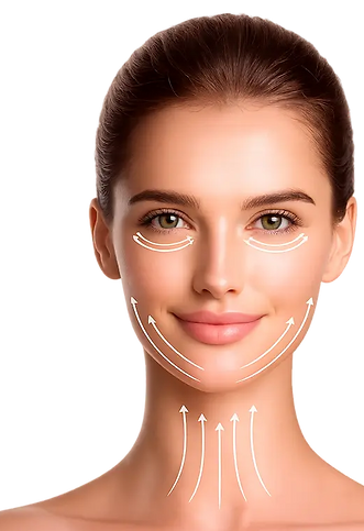 Diagram of THESERA L facelift target areas for non-invasive jawline and neck tightening results.