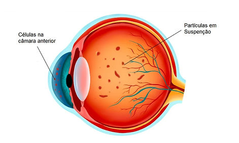 moscas volantes olho.jpg