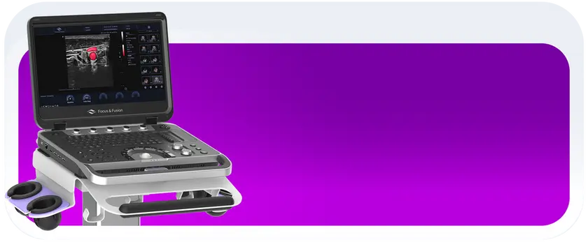 Foto do sistema de ultrassom portátil finus 55