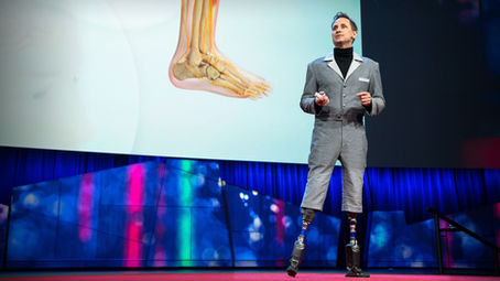 [Post]: The future of prosthetics and the man behind it