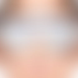 Warm Compresses and Eyelid Cleaning