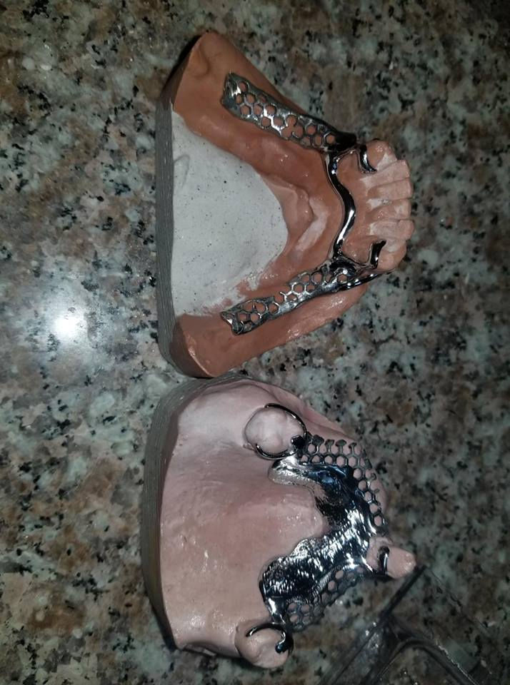 Miniatura: Prótesis Re Movible Cromo Cobalto