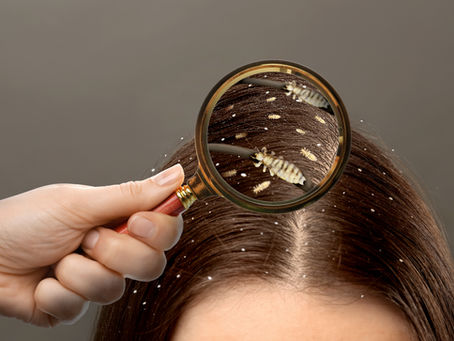 When Does Lice Season Start in Florida? How to Protect Your Head from Lice Year-Round