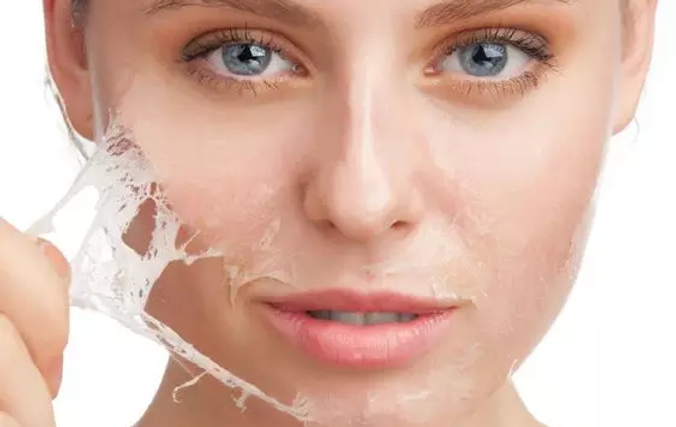 peeling.webp