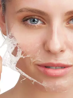 peeling.webp