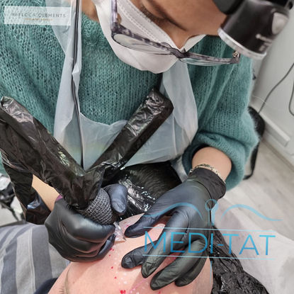 SMP by Meditat, Trondheim
Hodebunns tatovering av Meditat, Trondheim