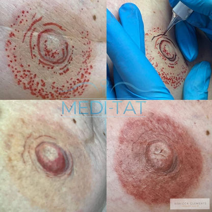 Areola tattoo By Rebecca Clements, Meditat, Trondheim