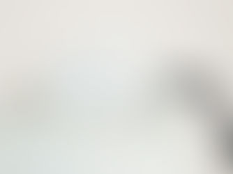 Laser Diode focalisé : un complément idéal de la cryolipolyse