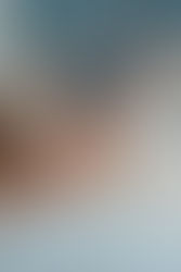 O que é a dor facetária?