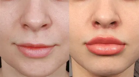 Cosmetic Trends of the Year: What Everyone’s Talking About