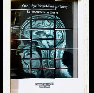 How I got introduced to One-Eye Ridgid-Finger Barry (My MS)