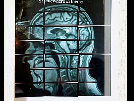 How I got introduced to One-Eye Ridgid-Finger Barry (My MS)